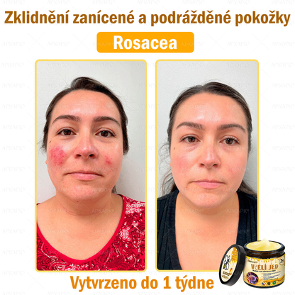 Dermatologicky a klinicky testováno👩‍⚕️APKAPK®Bee Venom Krém na obnovení pleti🐝 pomáhá při léčbě kožních problémů, jako jsou: vrásky, jizvy, pigmentové skvrny, strie, akné, psoriáza, ekzém, kožní změny, podráždění, záněty a další kožní problémy.