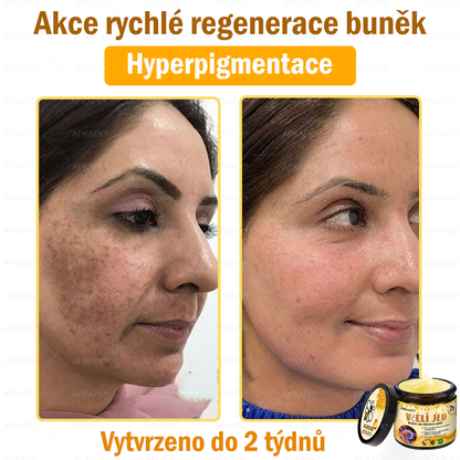 Dermatologicky a klinicky testováno👩‍⚕️APKAPK®Bee Venom Krém na obnovení pleti🐝 pomáhá při léčbě kožních problémů, jako jsou: vrásky, jizvy, pigmentové skvrny, strie, akné, psoriáza, ekzém, kožní změny, podráždění, záněty a další kožní problémy.